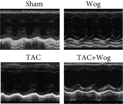 Wog Prevented TAC Induced Cardiac Hypertrophy And Dysfunction In Vivo