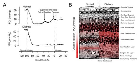 Figure 17 [retinal Oxygen Tension In Normal ] Webvision Ncbi Bookshelf