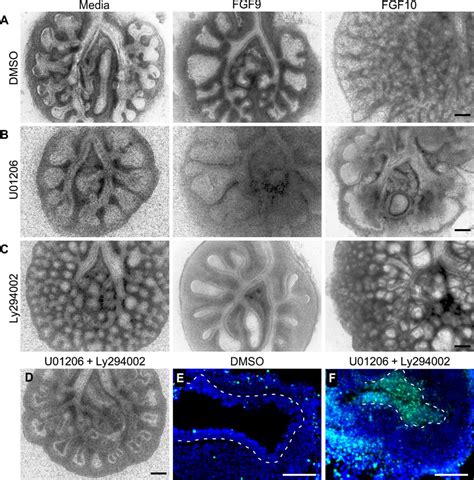 Fgf And Fgf Activate Distinct Signaling Pathways To Direct Lung