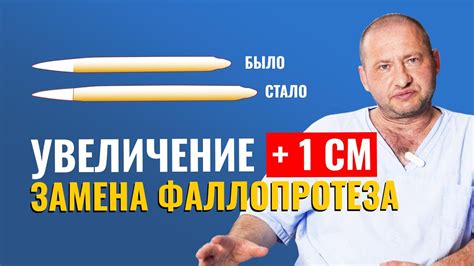 Фаллопротезирование - замена импланта при поломке. Увеличение полового ...