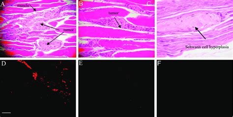 Histopathology And Immunostaining For The Schwann Cell Marker S