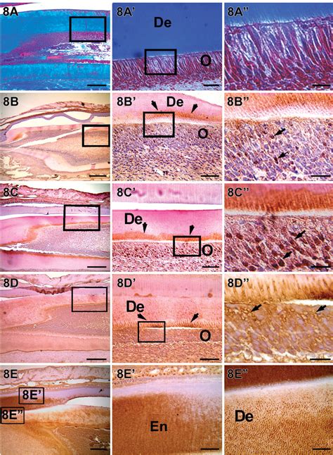 Temporal And Spatial Localization Of The Dentin Matrix Proteins During