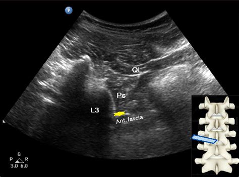 Figure 2 From A Brief Report On A Technical Description Of Ultrasound