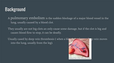 Ppt Pulmonary Embolism Powerpoint Presentation Free Download Id 194034