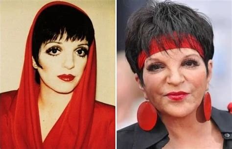 Liza Minnelli Before And After Plastic Surgery