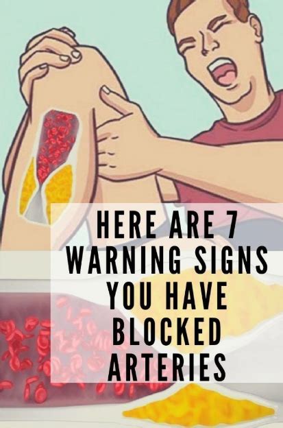 Here Are Warning Signs You Have Blocked Arteries All Recipes Guide