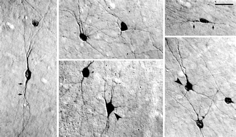 High Power Differential Interference Contrast Dic Photomicrographs Of