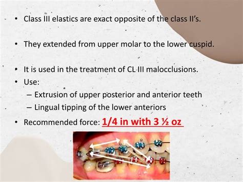 Intraoral Elastics In Orthodontics Pptx