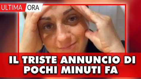 Benedetta Rossi Il Triste Annuncio Sui Social Sono Caduta In Un