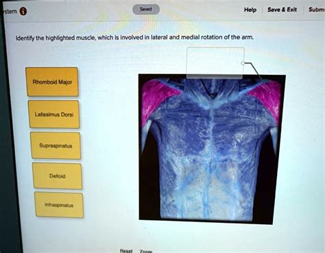 Solved Stem Saved Help Save Exit Subm Identify The Highlighted Muscle