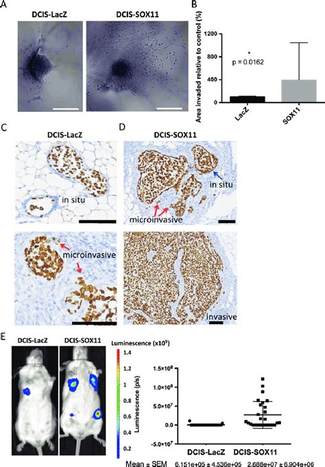 Sox11 Increases The Invasive Activity Of Dcis Cells In Vitro And Download Scientific Diagram