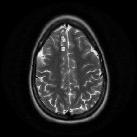 Viewing Playlist CNS Radiopaedia Org