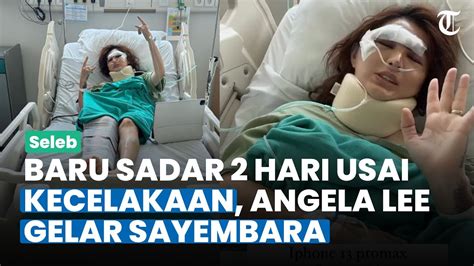 Kronologi Angela Lee Kecelakaan Langsung Gelar Sayembara Setelah Dua