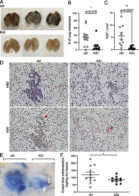 Kif13b Mediated Vegfr2 Trafficking Is Essential For Vascular Leakage And Metastasis In Vivo