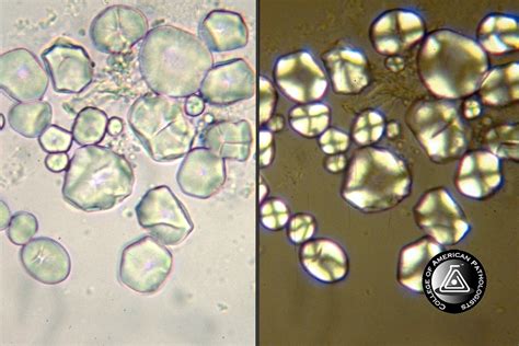 Urinalysis Competency Assessment 2012 - ProProfs Quiz