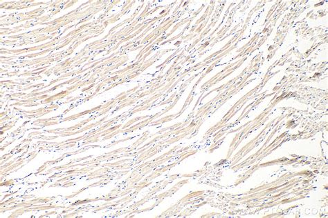 Tmem Antibody Ap Proteintech