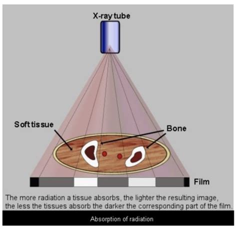 Unit 1 Week 1 Key Concepts Of Radiography Flashcards Quizlet