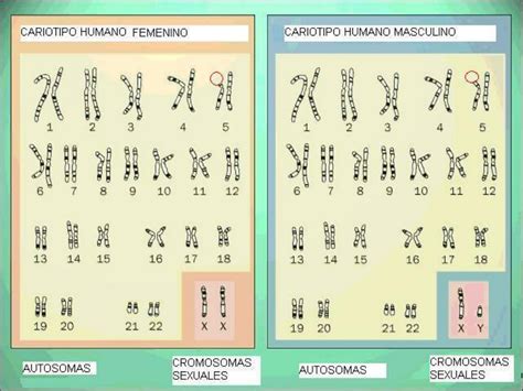 Ppt Trabajo Sobre El Síndrome De Cri Du Chat Powerpoint Presentation