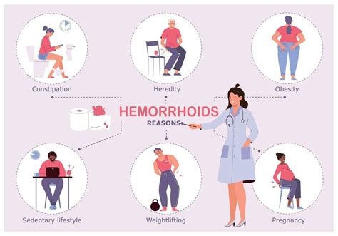 Hemorrhoid Reasons Infographic 31983987 Vector Art At Vecteezy