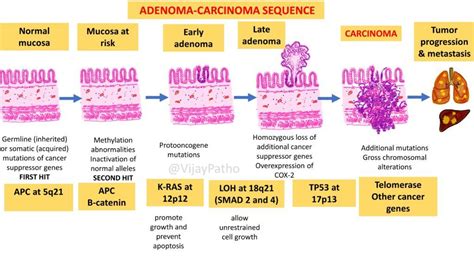 Pathogenesis Of Colorectal Cancer Pathology Made Simple