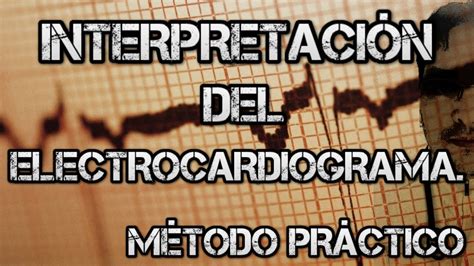 【aprende A Interpretar Un Electrocardiograma】rápido Fácil Y Sencillo