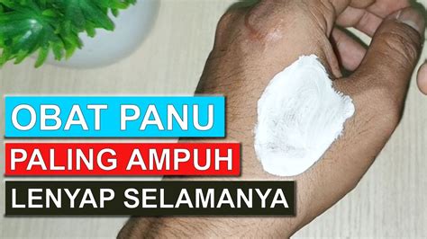 Obat Panu Paling Ampuh Atasi Panu Sampai Akarnya Cara Mengobati Panu