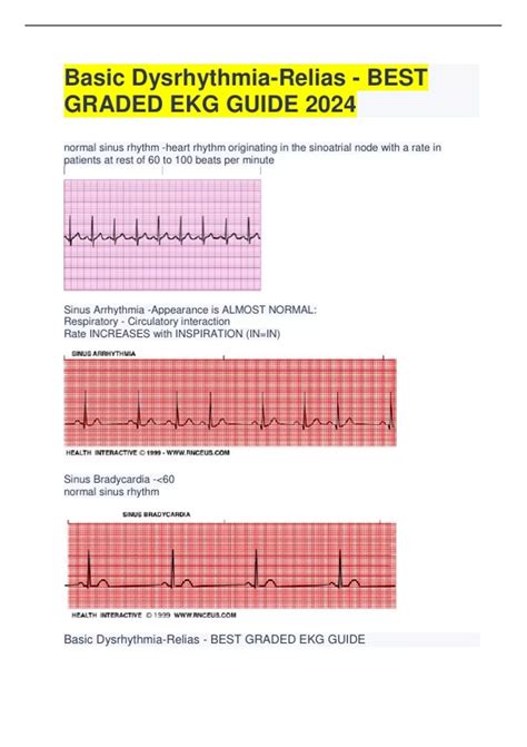 Basic Dysrhythmia Relias Best Graded Ekg Guide Test Answers 2024 A