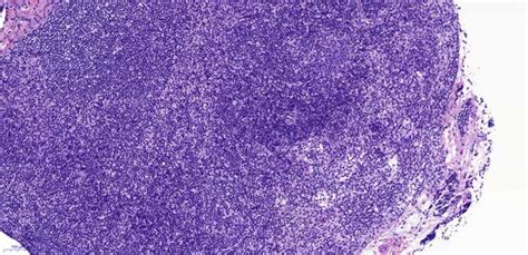 Hematoxylin And Eosin Stain Of A Representative Inguinal Lymph Node