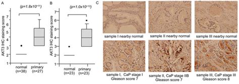 Akt3 Promotes Prostate Cancer Proliferation Cells Through Regulation Of