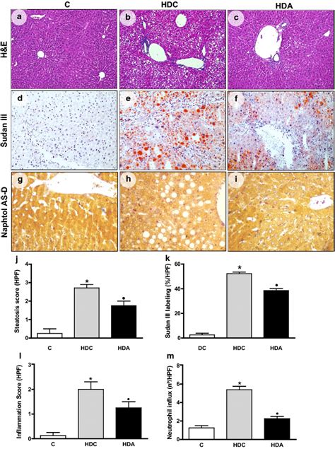 Representative Photomicrographs Of Liver Sections Stained With