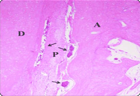 Decalcified H E Stained Section From Group Iii Showing Some Signs Of