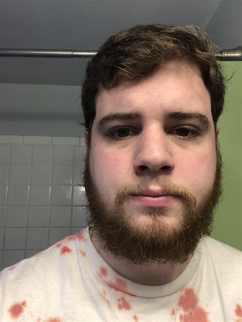 Hit Awkward Stage Need Advice 23 Year Old First Beard R Beards