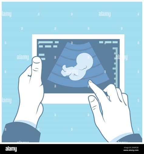 Ultrasonography Picture Ultrasound Scan Of Fetus In Hands Pregnancy