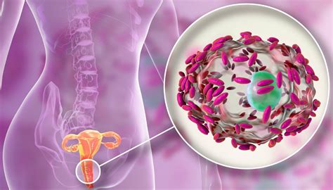 Como fazer banho de assento para candidíase corrimento infecção