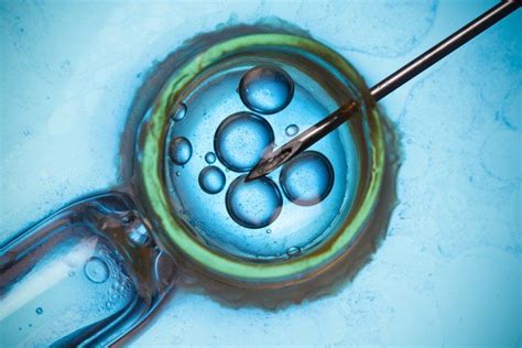 What Is IVF Your Snapshot Guide To Fertility Treatments Manchester