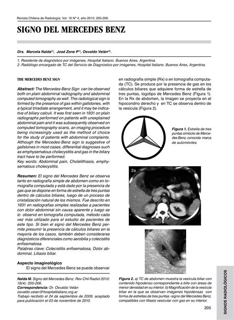 Pdf Signo Del Mercedes Benz