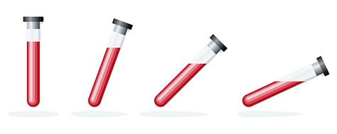 A Test Tube With A Blood Sample Round Glass Flared Vector Round Glass