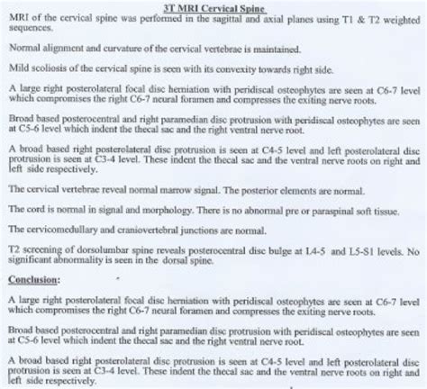 MRI & Disc Herniation — Herniated Discs from Car Accidents