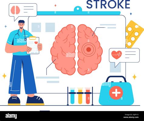 A Vector Illustration Of Human Brain Stroke Highlighting Medical