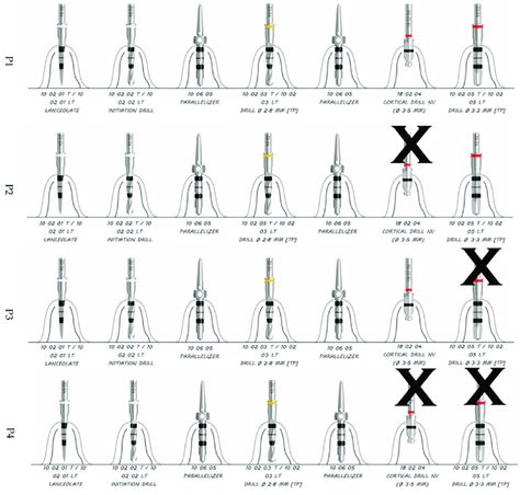 P1 P2 P3 And P4 Site Preparation Sequence For 3 5 Mm Diameter