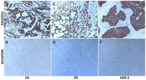 The Representative Immunohistochemistry Ihc Results Of Er Pr And