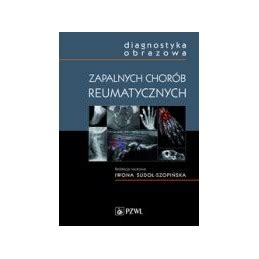 Diagnostyka Obrazowa Zapalnych Chor B Reumatycznych