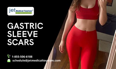 Gastric Sleeve Scars Minimize Scars To Stomach Jet Medical Tourism