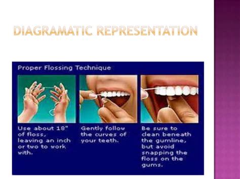 Flossing | PPT | Free Download