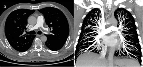 Angiography Imaging Services Singing River Health System