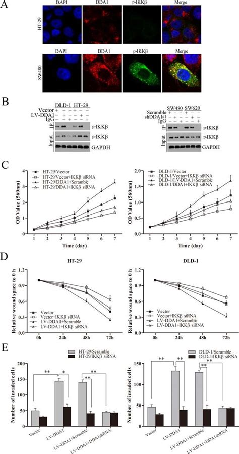 DDA1 activates the NFκB CSN2 GSK3β pathway by regulating IKKβ