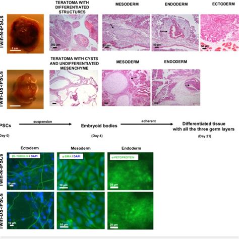 In Vivo And In Vitro Differentiation Of Normal And Ds Ipscs A