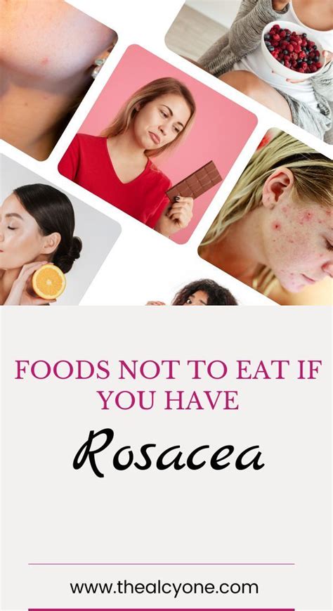 What is rosacea and what causes rosacea – Artofit