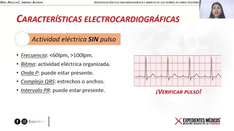 Conferencia No 2 Identificación electrocardiográfica y manejo de los