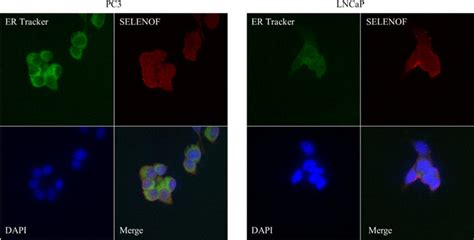 Selenof Levels And Cellular Location In Human Cell Lines Pc And Lncap